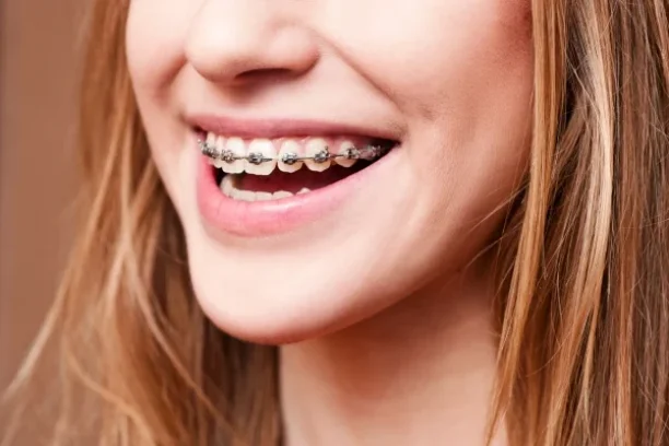 A_girl_smiling_with_traditional_braces